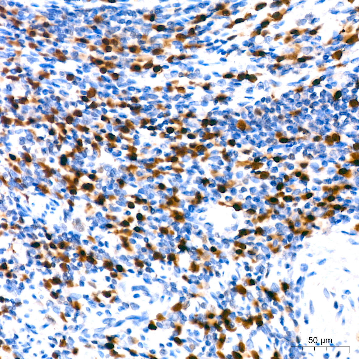 MUM1 Rabbit mAb