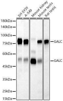 [KD Validated] GALC Rabbit mAb
