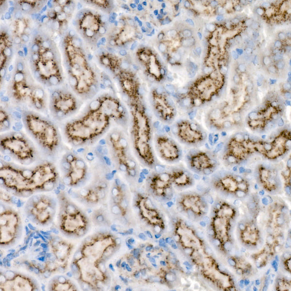 [KD Validated] GALC Rabbit mAb