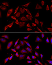 PKC alpha Rabbit mAb