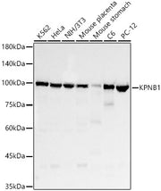 KPNB1 Rabbit mAb