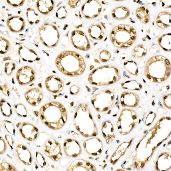 KPNB1 Rabbit mAb