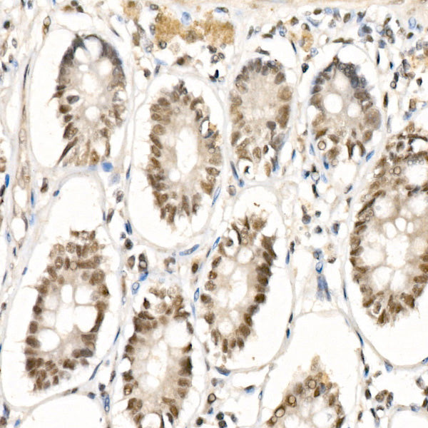 GLI1 Rabbit mAb