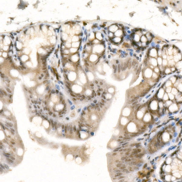 GLI1 Rabbit mAb