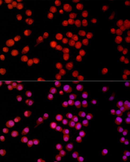 GLI1 Rabbit mAb