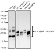 [KO Validated] Von Hippel Lindau/VHL Rabbit mAb