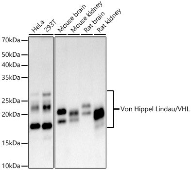 [KO Validated] Von Hippel Lindau/VHL Rabbit mAb