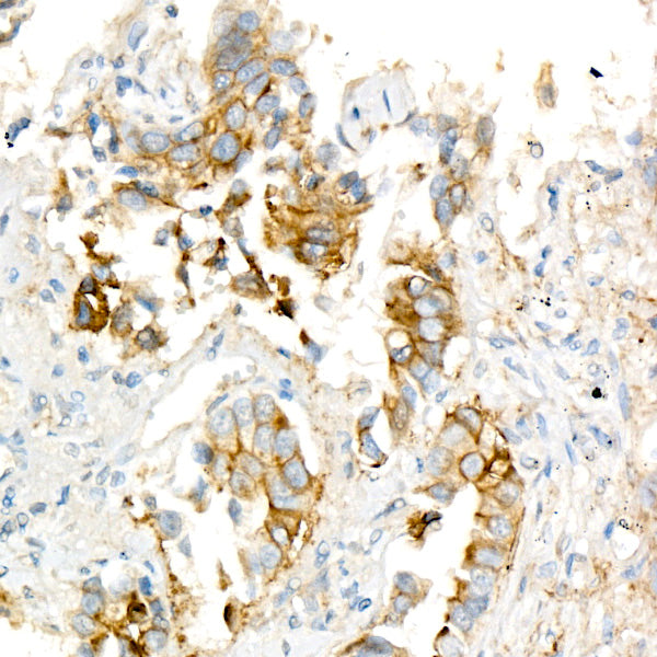 Coagulation factor III/Tissue Factor Rabbit mAb