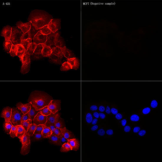 Coagulation factor III/Tissue Factor Rabbit mAb