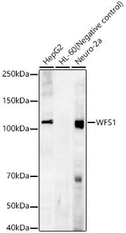 WFS1 Rabbit mAb