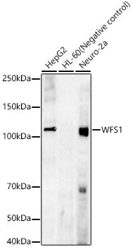 WFS1 Rabbit mAb