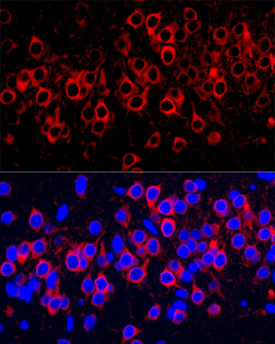 WFS1 Rabbit mAb