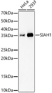 SIAH1 Rabbit mAb