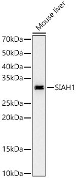 SIAH1 Rabbit mAb