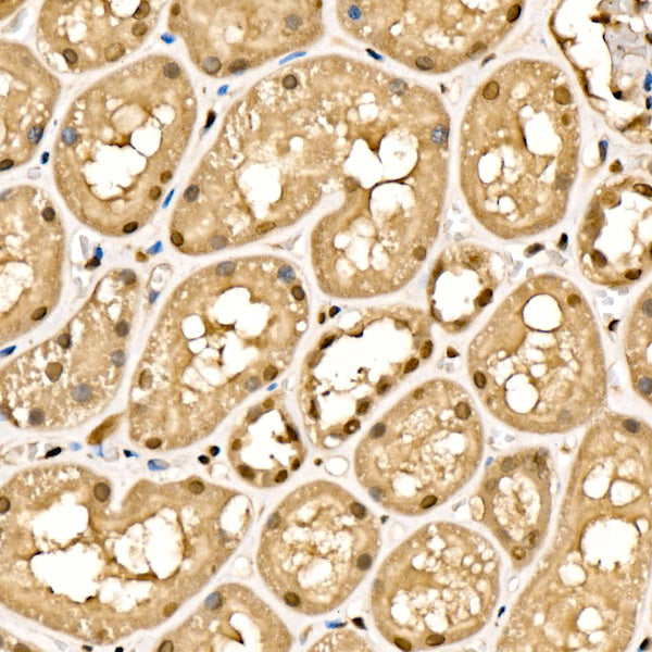 SIAH1 Rabbit mAb