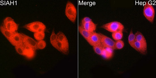 SIAH1 Rabbit mAb