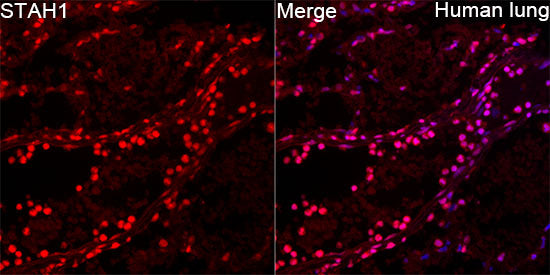 SIAH1 Rabbit mAb