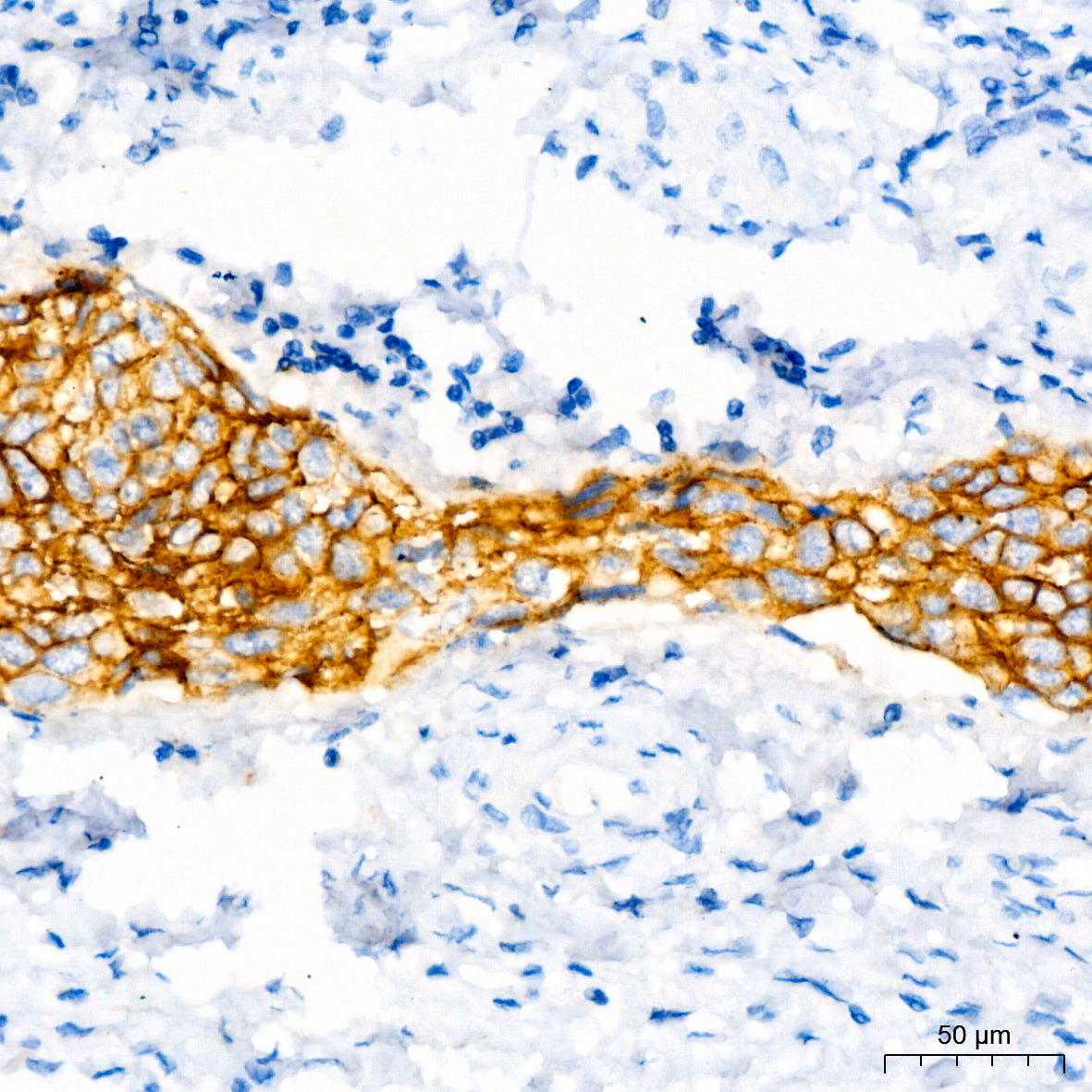 CD138/Syndecan-1 Rabbit mAb