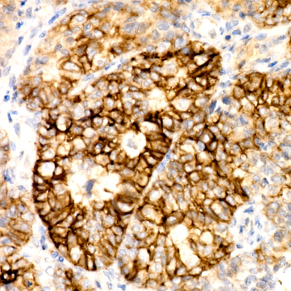 CD138/Syndecan-1 Rabbit mAb