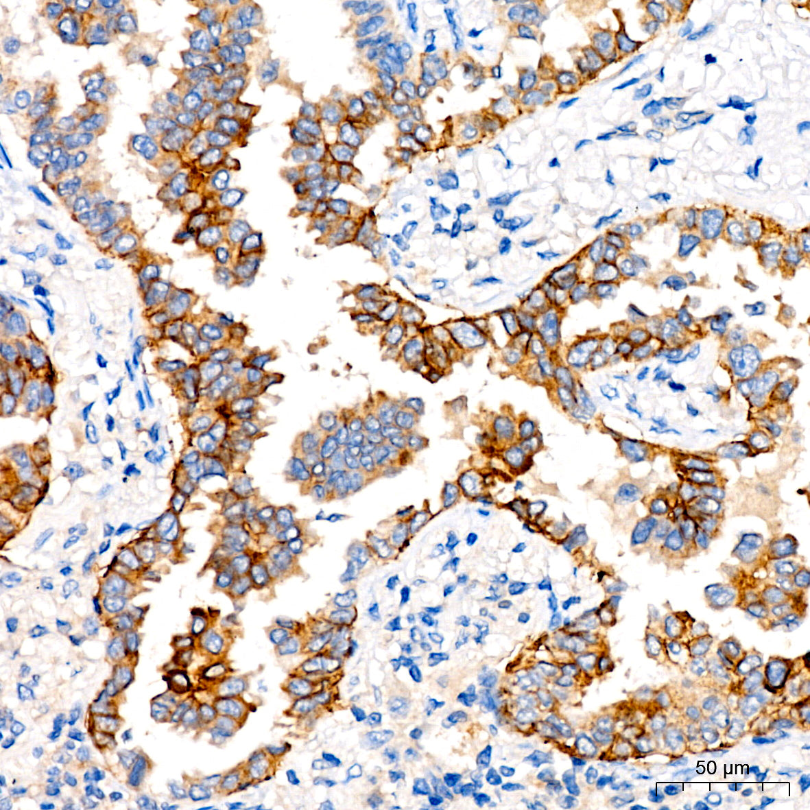 CD138/Syndecan-1 Rabbit mAb
