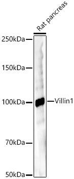 Villin1 Rabbit mAb