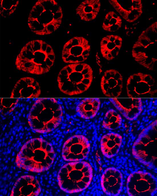 Villin1 Rabbit mAb