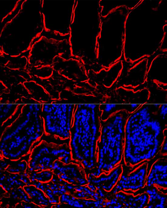 Villin1 Rabbit mAb