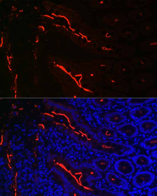 Villin1 Rabbit mAb