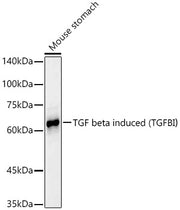TGF beta induced (TGFBI)  Rabbit mAb