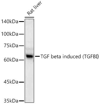 TGF beta induced (TGFBI)  Rabbit mAb