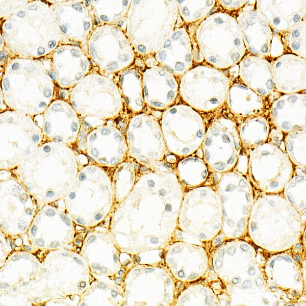 TGF beta induced (TGFBI)  Rabbit mAb