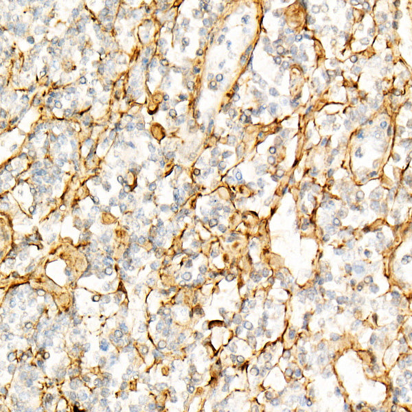 TGF beta induced (TGFBI)  Rabbit mAb