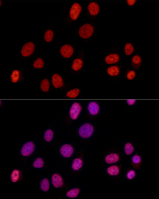 HNRNPD Rabbit mAb
