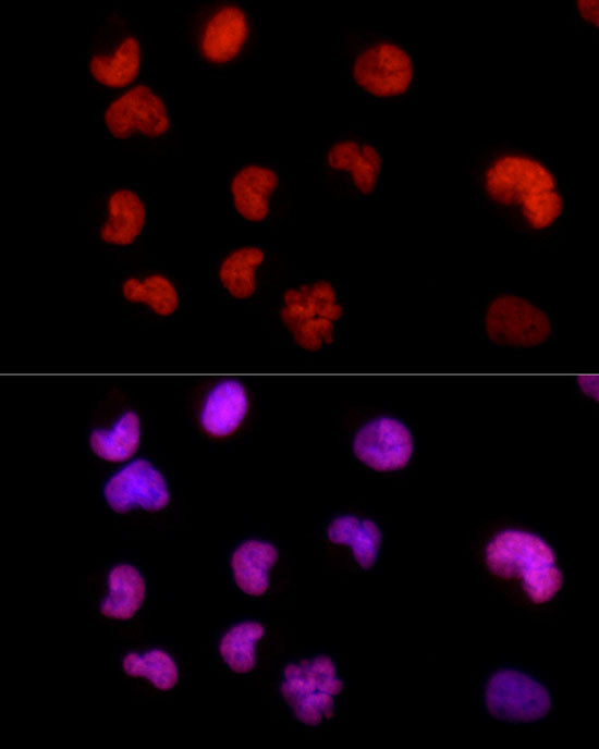 HNRNPD Rabbit mAb