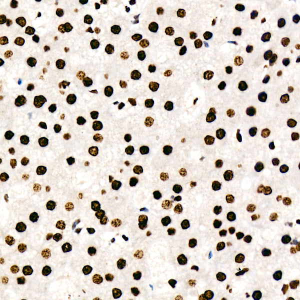 HNRNPD Rabbit mAb