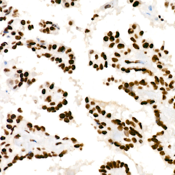 HNRNPD Rabbit mAb
