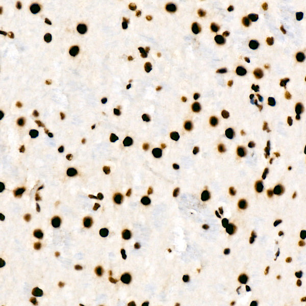 HNRNPD Rabbit mAb