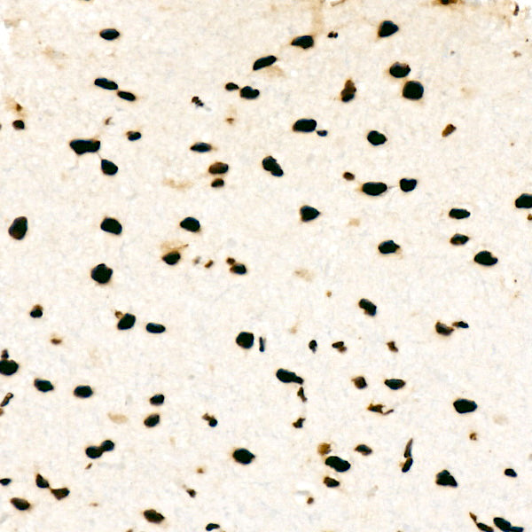 HNRNPD Rabbit mAb