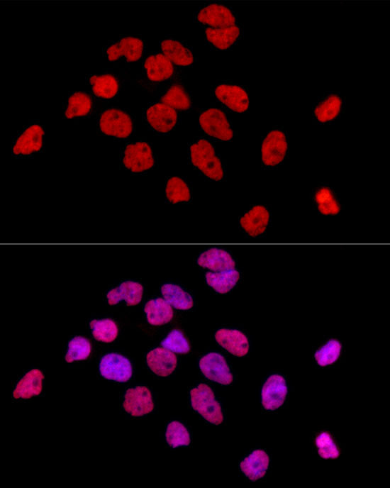 HNRNPD Rabbit mAb