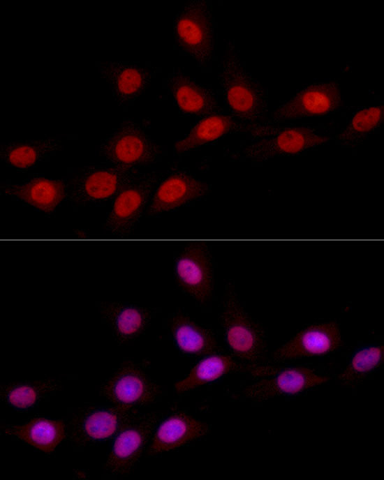 HNRNPD Rabbit mAb