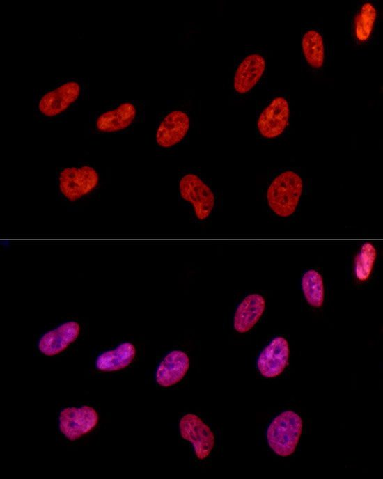 HNRNPD Rabbit mAb