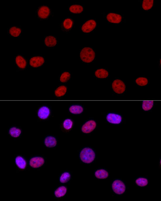 HNRNPD Rabbit mAb