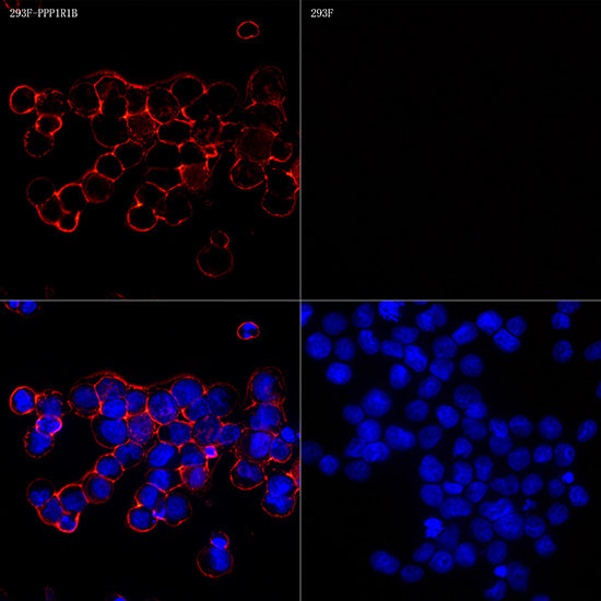 DARPP32 Rabbit mAb