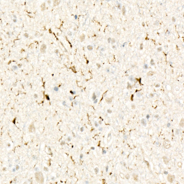 ABI3 Rabbit mAb
