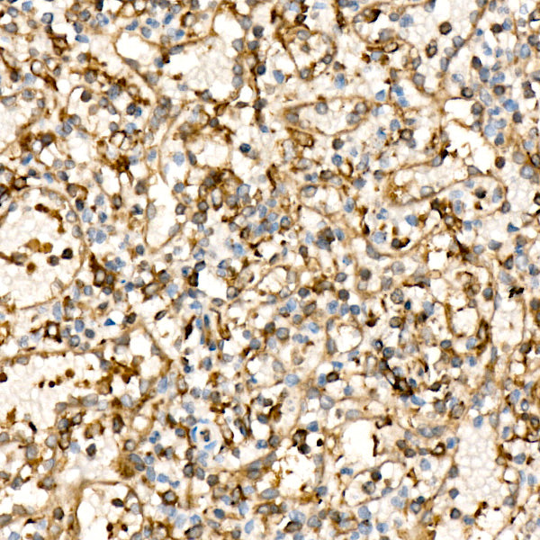 ABI3 Rabbit mAb