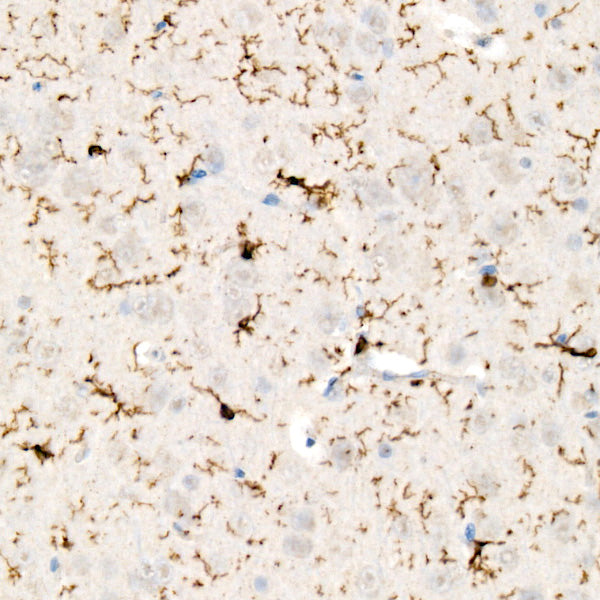 ABI3 Rabbit mAb