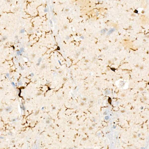 ABI3 Rabbit mAb
