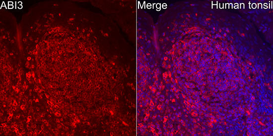 ABI3 Rabbit mAb