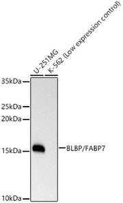 BLBP/FABP7 Rabbit mAb