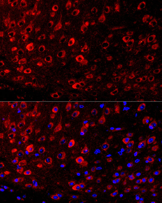 BLBP/FABP7 Rabbit mAb